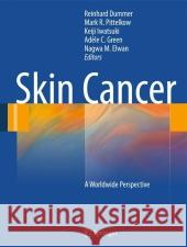 Skin Cancer - A World-Wide Perspective Reinhard Dummer Mark R. Pittelkow Kejii Iwatsuki 9783642050718 Not Avail