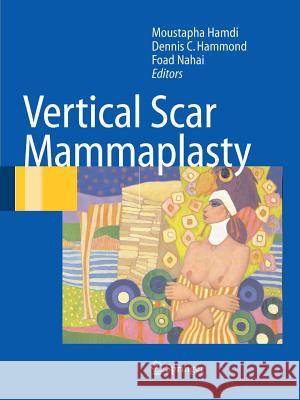 Vertical Scar Mammaplasty Moustapha Hamdi Dennis C. Hammond Foad Nahai 9783642060458 Not Avail