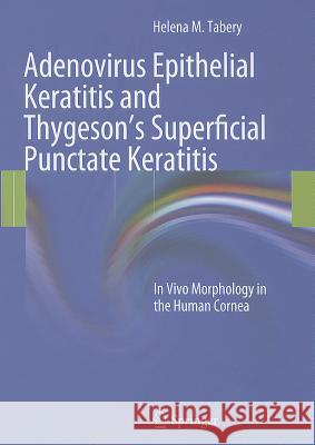 Adenovirus Epithelial Keratitis and Thygeson's Superficial Punctate Keratitis: In Vivo Morphology in the Human Cornea Tabery, Helena M. 9783642216336 Springer