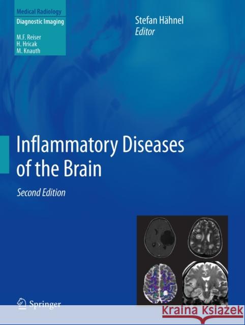 Inflammatory Diseases of the Brain Stefan H 9783642305191 Springer