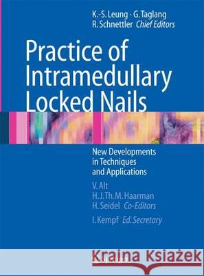Practice of Intramedullary Locked Nails: New Developments in Techniques and Applications Alt, Volker 9783642444142 Springer