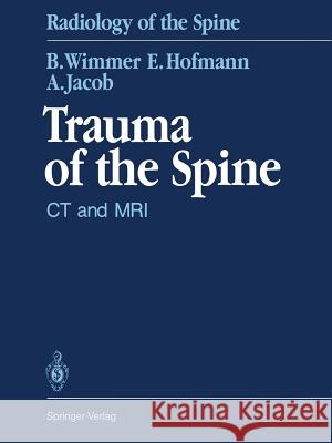 Trauma of the Spine: CT and MRI Wenz, W. 9783642456688 Springer