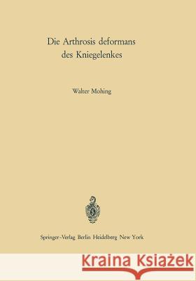 Die Arthrosis Deformans Des Kniegelenkes: Ätiologie - Pathogenese - Klinik - Begutachtung Idelberger, K. 9783642484674 Springer