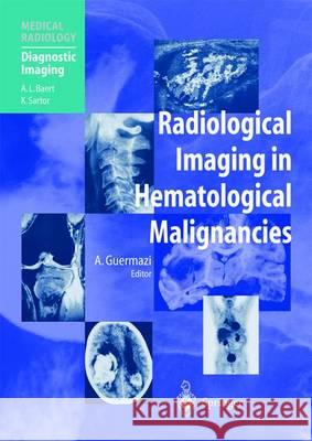 Radiological Imaging in Hematological Malignancies Ali Guermazi R. a. Castellino 9783642623134
