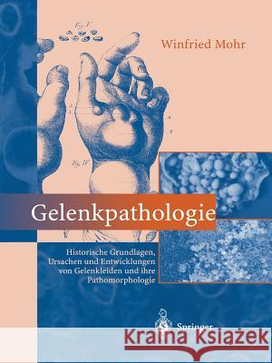Gelenkpathologie: Historische Grundlagen, Ursachen Und Entwicklungen Von Gelenkleiden Und Ihre Pathomorphologie Mohr, Winfried 9783642630156 Springer