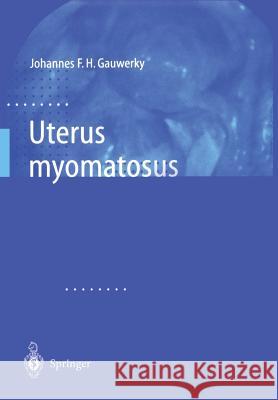 Uterus Myomatosus Johannes F. H. Gauwerky Johannes F 9783642631399 Springer