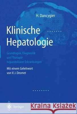 Klinische Hepatologie: Grundlagen, Diagnosik Und Therapie Hepatobiliärer Erkrankungen Dancygier, Henryk 9783642631825