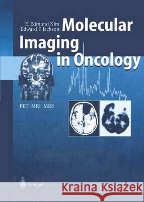 Molecular Imaging in Oncology: Pet, Mri, and Mrs Kim, E. Edmund 9783642641633 Springer