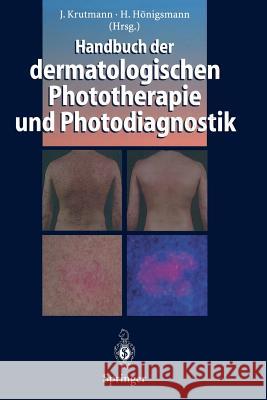 Handbuch Der Dermatologischen Phototherapie Und Photodiagnostik Krutmann, Jean 9783642644016 Springer