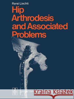 Hip Arthrodesis and Associated Problems R. Liechti P. a. Casey M. F. M 9783642668753 Springer