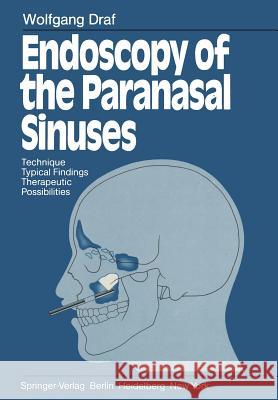 Endoscopy of the Paranasal Sinuses: Technique - Typical Findings Therapeutic Possibilities Draf, Wolfgang 9783642684142