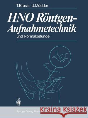 Hno Röntgen-Aufnahmetechnik Und Normalbefunde Brusis, T. 9783642692406 Springer