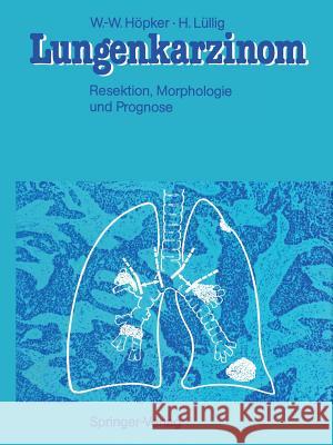 Lungenkarzinom: Resektion, Morphologie Und Prognose Höpker, Wilhelm-Wolfgang 9783642715303 Springer