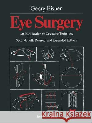 Eye Surgery: An Introduction to Operative Technique Telger, Terry C. 9783642718014 Springer