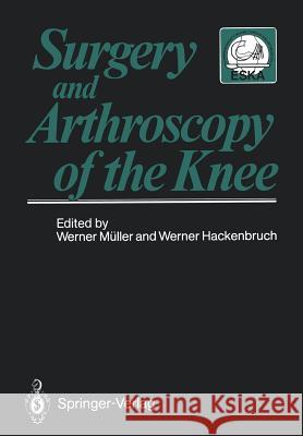 Surgery and Arthroscopy of the Knee: Second European Congress of Knee Surgery and Arthroscopy Basel, Switzerland, 29.Sept.-4.Oct.1986 Müller, Werner 9783642727849