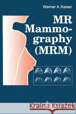 MR Mammography (Mrm) Kaiser, Werner A. 9783642772580 Springer