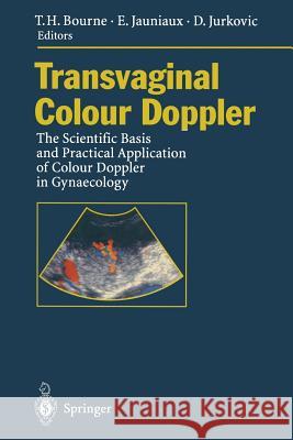 Transvaginal Colour Doppler: The Scientific Basis and Practical Application of Colour Doppler in Gynaecology Bourne, Tom H. 9783642792663 Springer