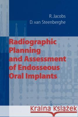 Radiographic Planning and Assessment of Endosseous Oral Implants Reinhilde Jacobs Daniel Van Steenberghe 9783642804267 Springer