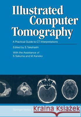 Illustrated Computer Tomography: A Practical Guide to CT Interpretations Takahashi, S. 9783642818165 Springer
