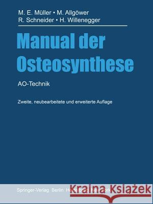 Manual Der Osteosynthese: Ao-Technik Müller, Maurice E. 9783642963834 Springer