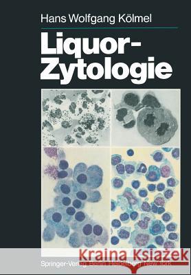 Liquor-Zytologie H. W. K J. Sayk 9783642964596 Springer