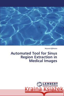 Automated Tool for Sinus Region Extraction in Medical Images Igbinosa Ireyuwa 9783659249235 LAP Lambert Academic Publishing