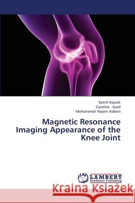 Magnetic Resonance Imaging Appearance of the Knee Joint Kajoak Samih                             Ayad Caroline                            Najem Aldeen Mohammed 9783659375606 LAP Lambert Academic Publishing
