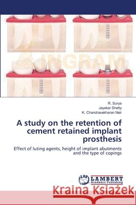 A study on the retention of cement retained implant prosthesis Surya, R. 9783659417207 LAP Lambert Academic Publishing