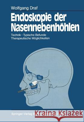 Endoskopie Der Nasennebenhöhlen: Technik - Typische Befunde, Therapeutische Möglichkeiten Kley, Walter 9783662070222