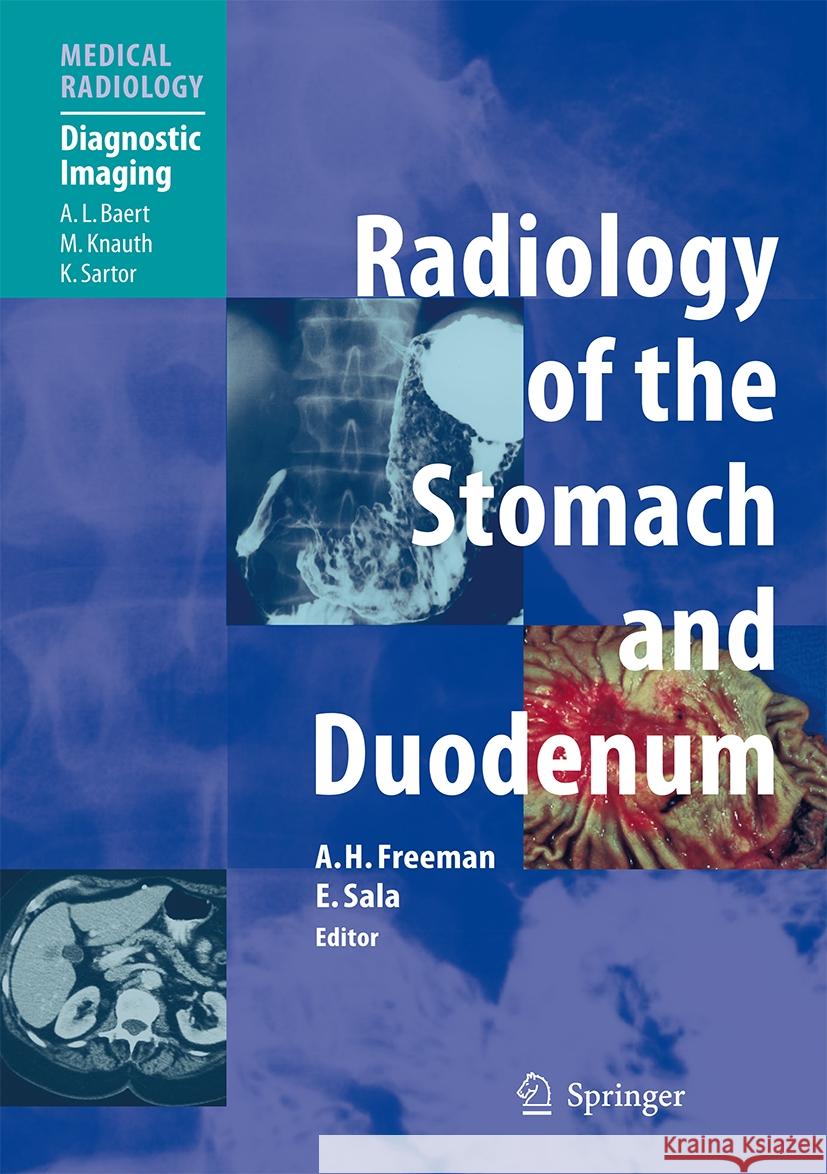 Radiology of the Stomach and Duodenum Alan H. Freeman E. Sala A. L. Baert 9783662496053