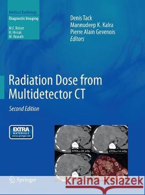 Radiation Dose from Multidetector CT Denis Tack Mannudeep K. Kalra Pierre Alain Gevenois 9783662500392 Springer