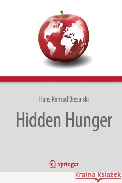 Hidden Hunger Hans Konrad Biesalski Patrick O'Mealy 9783662508206 Springer