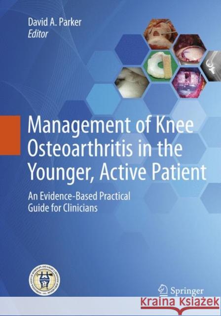 Management of Knee Osteoarthritis in the Younger, Active Patient: An Evidence-Based Practical Guide for Clinicians Parker, David 9783662569344