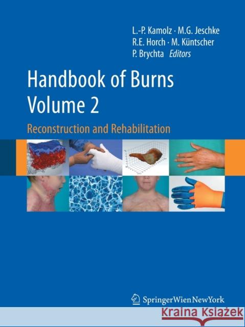 Handbook of Burns, Volume 2: Reconstruction and Rehabilitation Kamolz, Lars-Peter 9783709119211 Springer