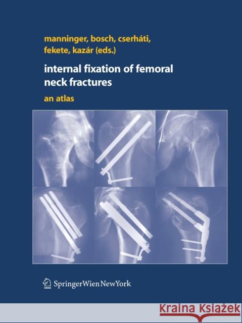 Internal Fixation of Femoral Neck Fractures: An Atlas Manninger, Jenó 9783709120026 Springer