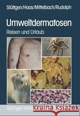 Umweltdermatosen: Reisen Und Urlaub Stüttgen, G. 9783709186534 Springer