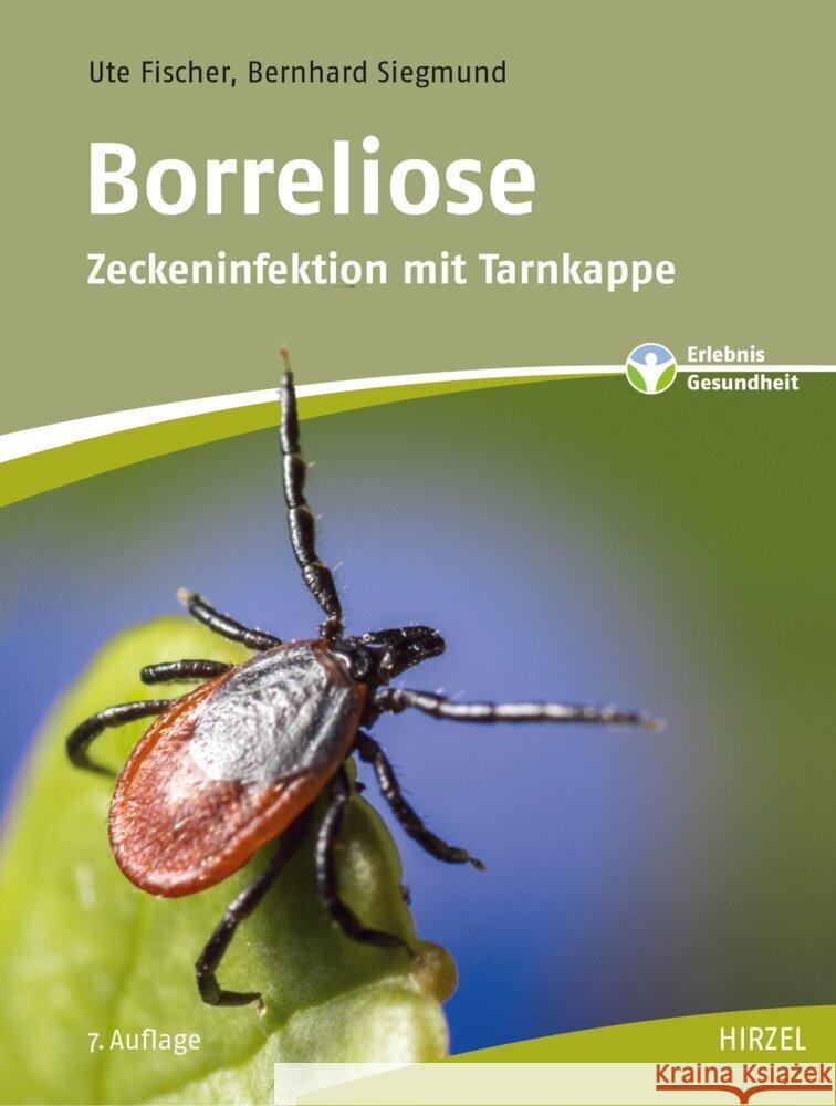 Borreliose Fischer, Ute, Siegmund, Bernhard 9783777628165