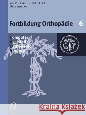 Computer Assisted Orthopedic Surgery A. B. Imhoff 9783798511842 Steinkopff-Verlag Darmstadt