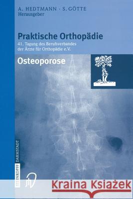 Osteoporose A. Hedtmann Siegfried Gvtte Siegfried G??tte 9783798513006 Steinkopff-Verlag Darmstadt
