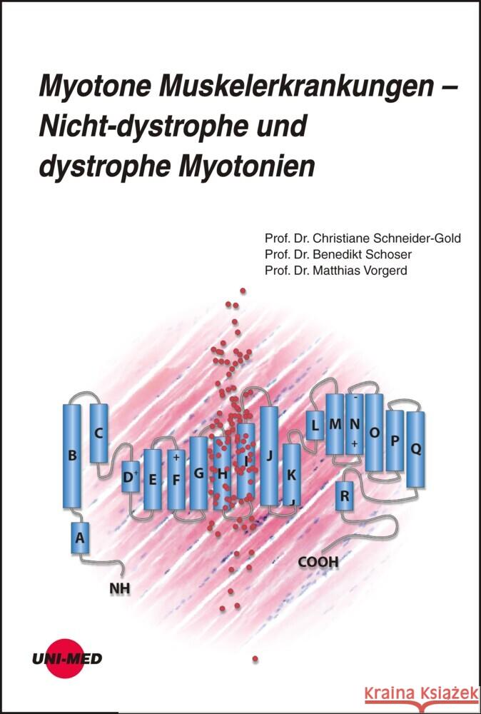 Myotone Muskelerkrankungen - Nicht-dystrophe und dystrophe Myotonien Schneider-Gold, Christiane, Schoser, Benedikt, Vorgerd, Matthias 9783837424317