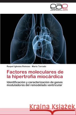 Factores moleculares de la hipertrofia miocárdica Iglesias Reinoso Raquel 9783844347197 Editorial Academica Espanola
