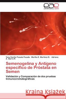Semenogelina y Antígeno específico de Próstata en Semen Posada Posada Yeny Cecilia 9783846574249 Editorial Acad Mica Espa Ola