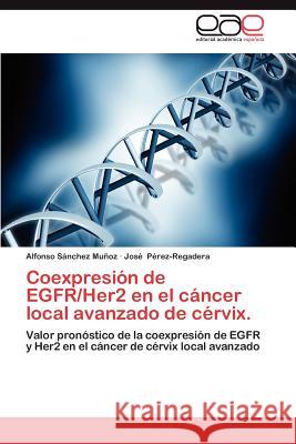 Coexpresion de Egfr/Her2 En El Cancer Local Avanzado de Cervix. Alfonso S Jos P 9783847355908 Editorial Acad Mica Espa Ola