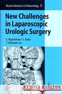 New Challenges in Laparoscopic Urologic Surgery Eiji Higashihara Seiji Naito Tadashi Matsuda 9784431012191 Springer