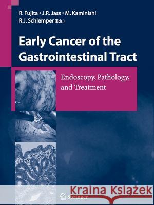 Early Cancer of the Gastrointestinal Tract: Endoscopy, Pathology, and Treatment Fujita, R. 9784431560852 Springer
