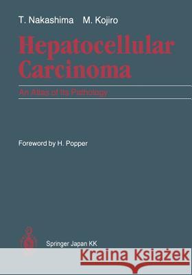 Hepatocellular Carcinoma: An Atlas of Its Pathology Popper, H. 9784431683360