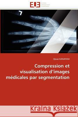 Compression Et Visualisation D Images Médicales Par Segmentation Kanafani-Q 9786131586828 Editions Universitaires Europeennes