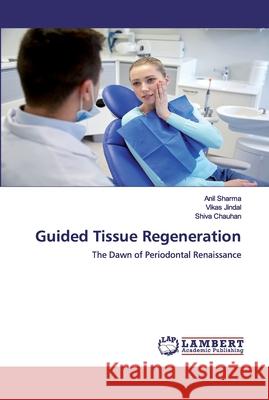 Guided Tissue Regeneration Sharma, Anil 9786200548719