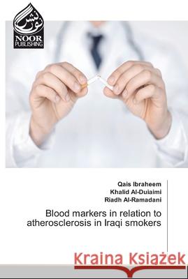 Blood markers in relation to atherosclerosis in Iraqi smokers Ibraheem, Qais; Al-Duiaimi, Khalid; Al-Ramadani, Riadh 9786202356305 Noor Publishing