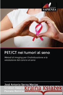 PET/CT nei tumori al seno José Antonio Serna Macias, Cristian Alejandro Cabezas Ortiz, Pamela Ramírez Carpinteyro 9786203113891